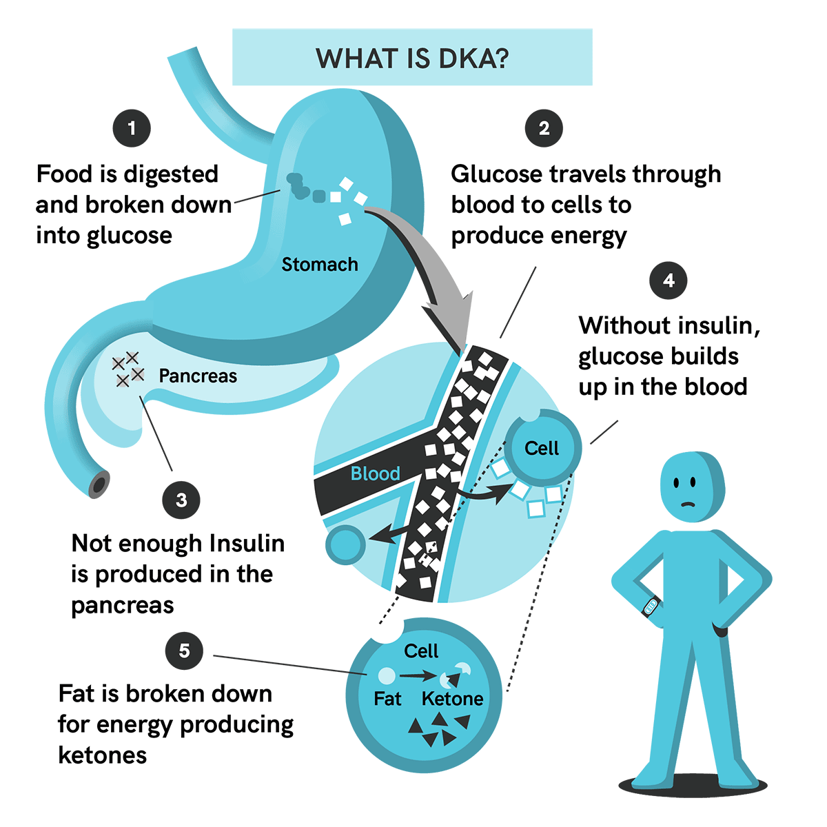 What is DKA?